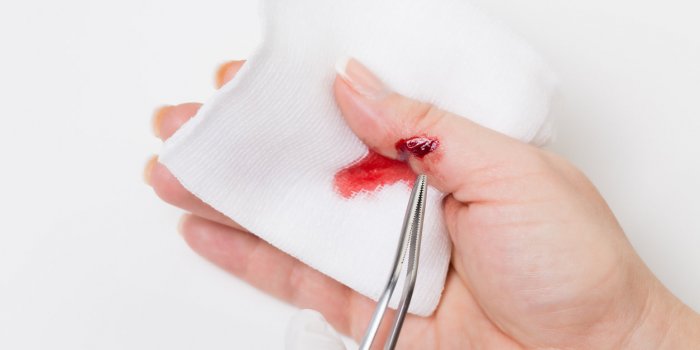 SepticÃ©mie : 7 Ã©tapes clÃ©s pour dÃ©sinfecter la plaie 