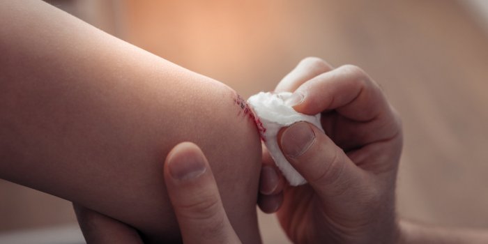 SepticÃ©mie : 7 Ã©tapes clÃ©s pour dÃ©sinfecter la plaie 