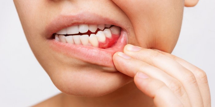 Ménopause : 6 symptômes que votre dentiste peut repérer