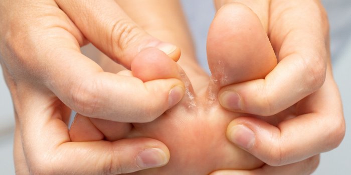 Maladies de peau : 7 huiles essentielles qui soignent !Â 