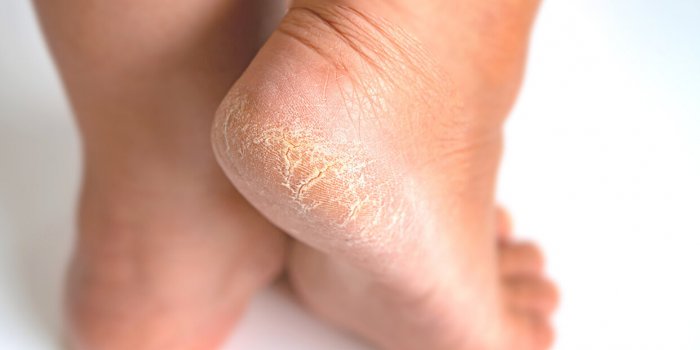 Ce que vos pieds disent de votre Ã©tat de santÃ©