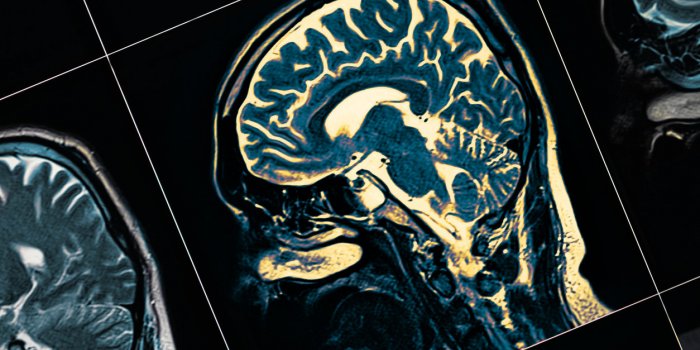 10 maladies qui changent la personnalité