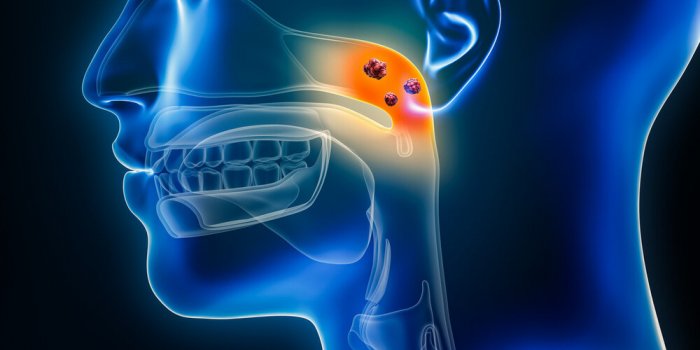 nasopharynx cancer with organs and tumors or cancerous cells 3d rendering illustration anatomy, oncology, pharynx disease...