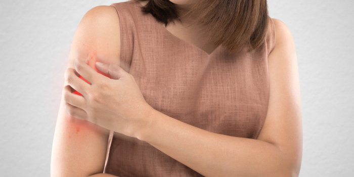 asian women who are itching from insect bites against gray wall background health care and medicine people with skin ...