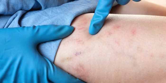 Cure thermale : 7 pathologies qui donnent droit Ã  prise en charge par l'Assurance Maladie