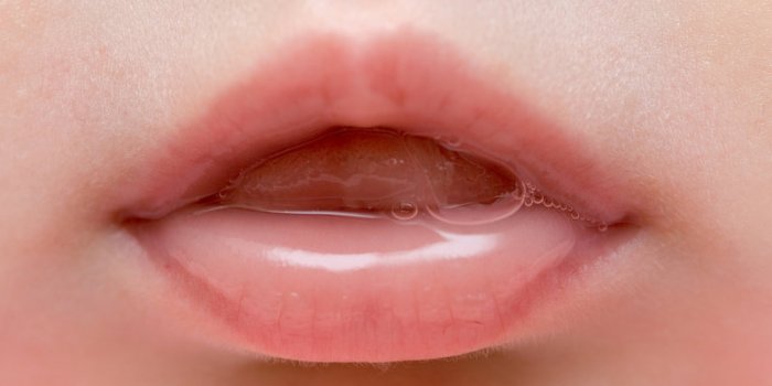 Iode : 7 complications d'un surdosage