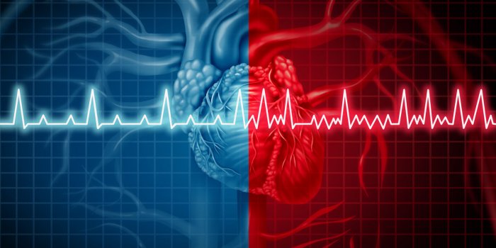 AVC : les 5 facteurs de risque sous-diagnostiqués