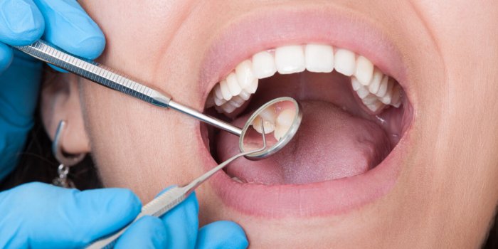7 signes d'un microbiote buccal en mauvaise santé
