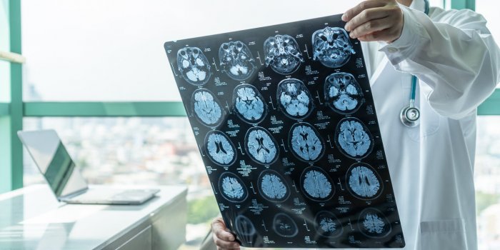 Covid-19 : les actes médicaux qui ont enregistré le plus de déprogrammations