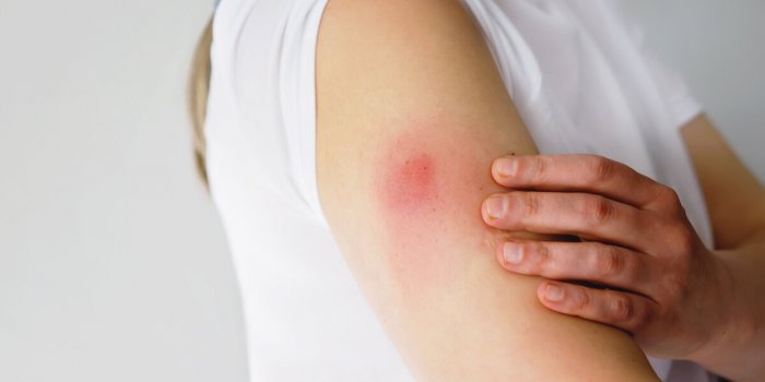 7 effets secondaires du vaccin contre la grippe Ã  connaÃ®tre