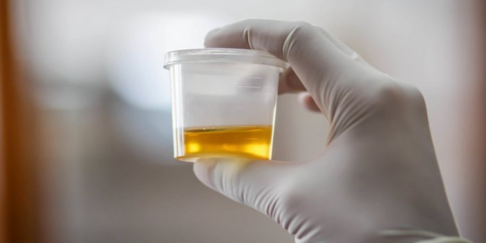 urine sample