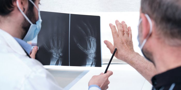 7 idÃ©es reÃ§ues sur l'arthrose dÃ©montÃ©es par notre rhumatologue