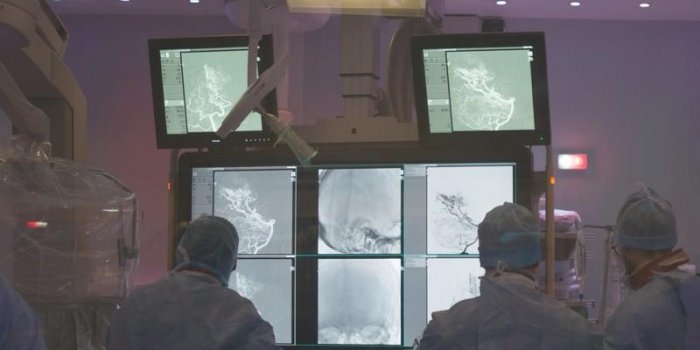 Comment réparer une malformation artério-veineuse dans le cerveau : les images au bloc