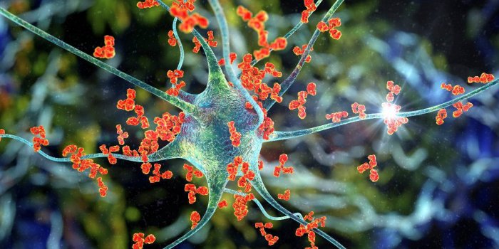 Cerveau : 5 maladies qui attaquent les zones du langage