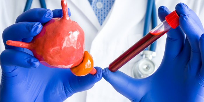 Trop dâexamens mÃ©dicaux sont prescrits inutilement, alerte 60 millions de consommateurs
