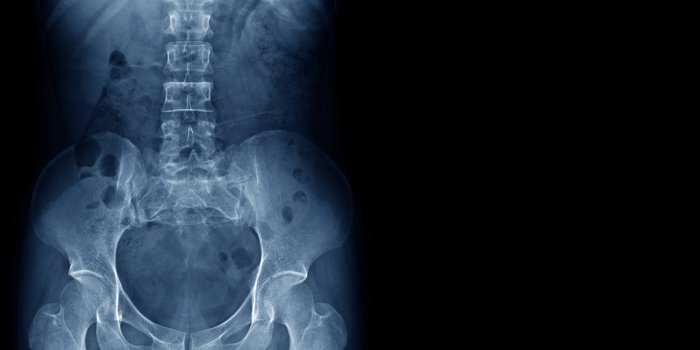Trop dâexamens mÃ©dicaux sont prescrits inutilement, alerte 60 millions de consommateurs