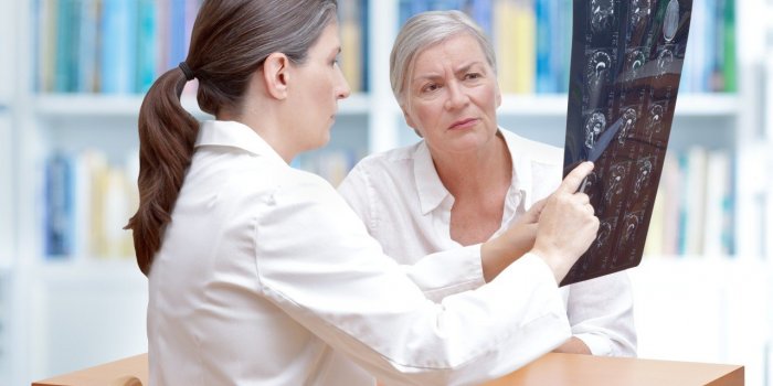 Cancer : 5 idées reçues sur les tumeurs cérébrales
