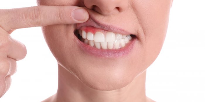 7 conseils de dentiste pour choisir son dentifrice après 60 ans