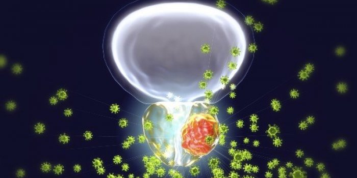 12 cancers oÃ¹ le taux de survie sâest amÃ©liorÃ©