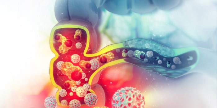Cancer : les Ã¢ges oÃ¹ vous Ãªtes le plus Ã  risque