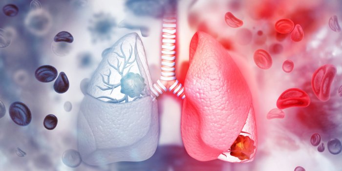 Cancer : les Ã¢ges oÃ¹ vous Ãªtes le plus Ã  risque