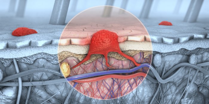 Cancer : les Ã¢ges oÃ¹ vous Ãªtes le plus Ã  risque