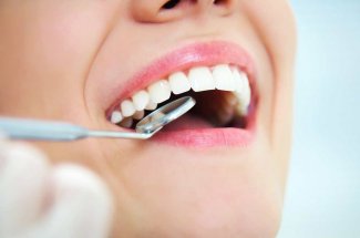 Une bacterie responsable des caries rendrait le cancer du colon plus agressif