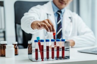 Un simple test sanguin pourrait etre efficace pour detecter ce type de cancer
