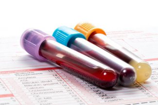 Don de sang : quelles sont les contre-indications ? 