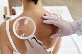 Une enquete revele les difficultes d’acces aux soins des Francais atteints de psoriasis