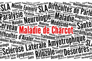 L’Inserm identifie un signe precurseur de la maladie de Charcot (SLA), visible des annees avant les symptomes moteurs