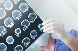 Parkinson : l’ortie, un traitement novateur !