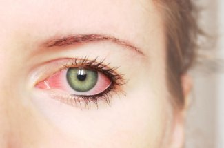 Pourquoi j’ai les yeux rouges ?