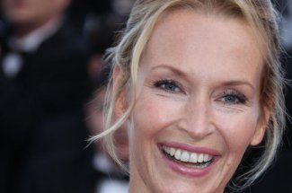 Botox : Estelle Lefebure evoque son recours a la chirurgie esthetique