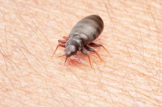 Invasion de punaises de lit : les regions les plus touchees
