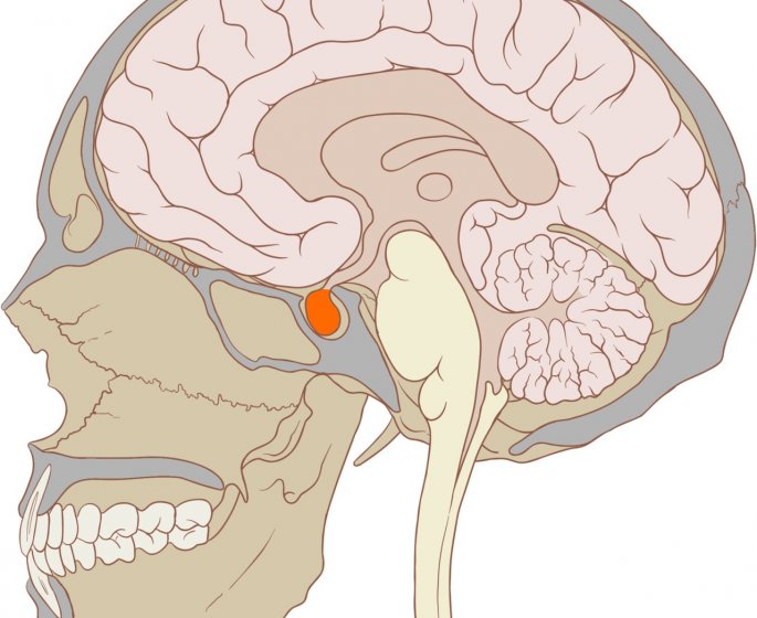 Acromegalie : definition, symptomes, diagnostic, traitements