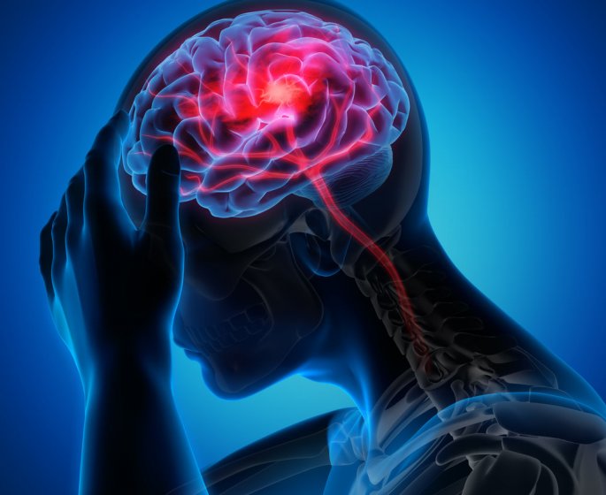 Accident vasculaire cerebral (AVC) : symptomes, definition, signes, causes, traitements