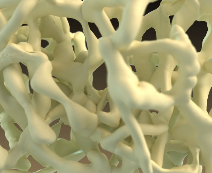 Osteomalacie : symptomes, causes, diagnostic, traitements