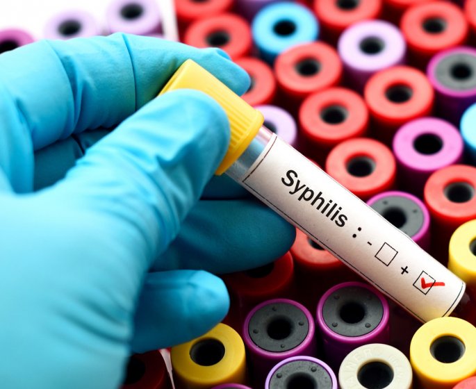 Syphilis : symptomes, traitements, transmission et depistage