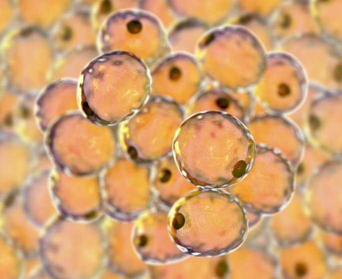 Lipome (tumeur ou boule de graisse) : comment l-enlever ?