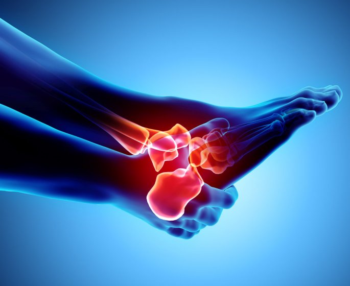 Aponevrosite plantaire (fasciite plantaire) : quels traitements pour soulager la douleur au pied ?