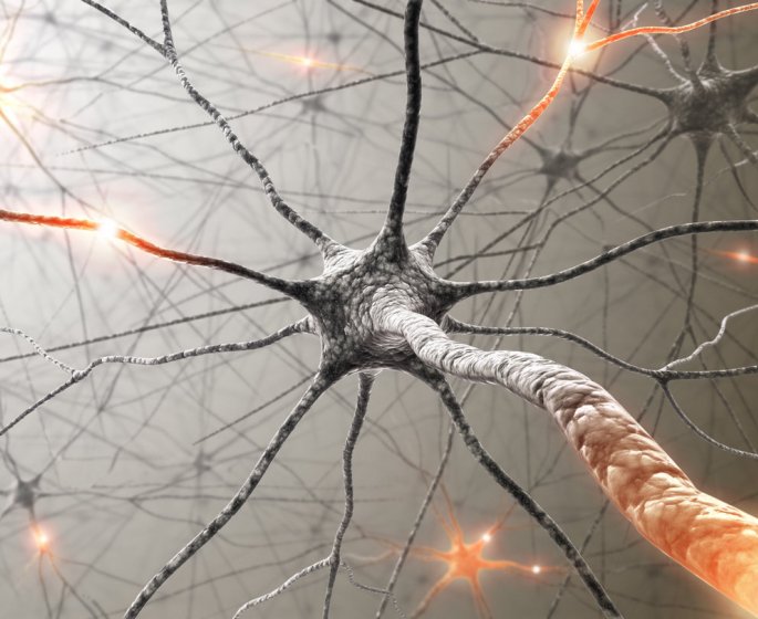 Polynevrite ou polyneuropathie distale chronique : definition, symptomes, traitements