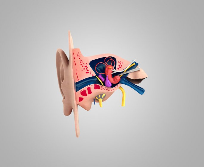 Neurinome de l-acoustique : symptomes, causes, traitements