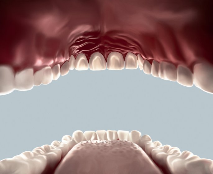 Stomatite : comment soigner l’inflammation de la muqueuse de la bouche ?