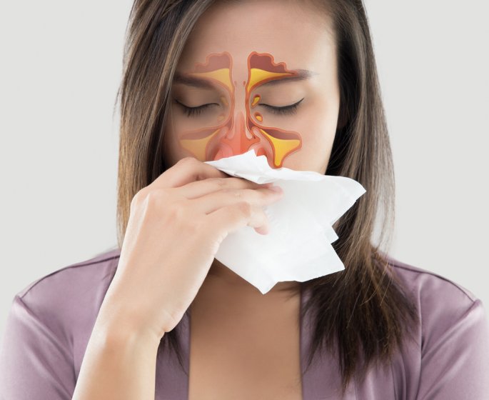 Sinusite : symptomes, causes, traitement et prevention