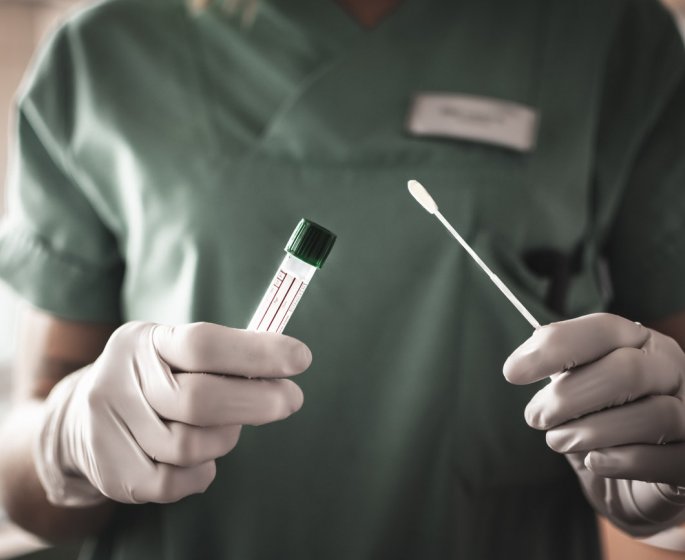 Tests du Coronavirus Covid-19 : qui peut se faire depister ?