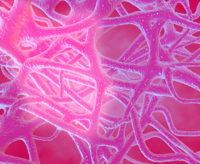 Polyarthrite rhumatoide : symptomes, causes, traitements pour la soigner