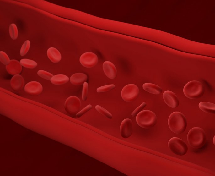 Arteriosclerose : definition, causes, examen, traitements
