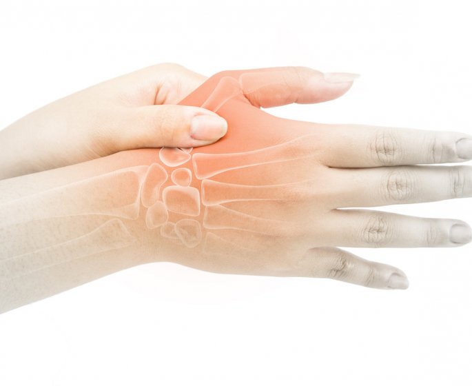 Rhizarthrose : definition, symptomes, causes, traitements