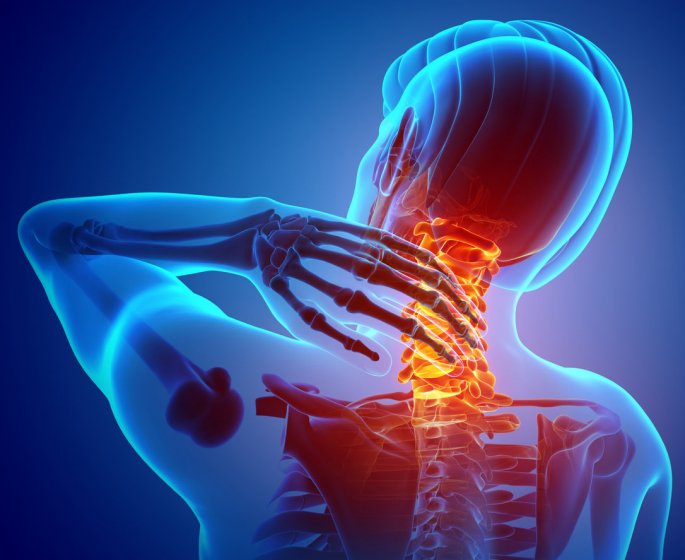 Cervicalgie : symptomes, complications, traitements